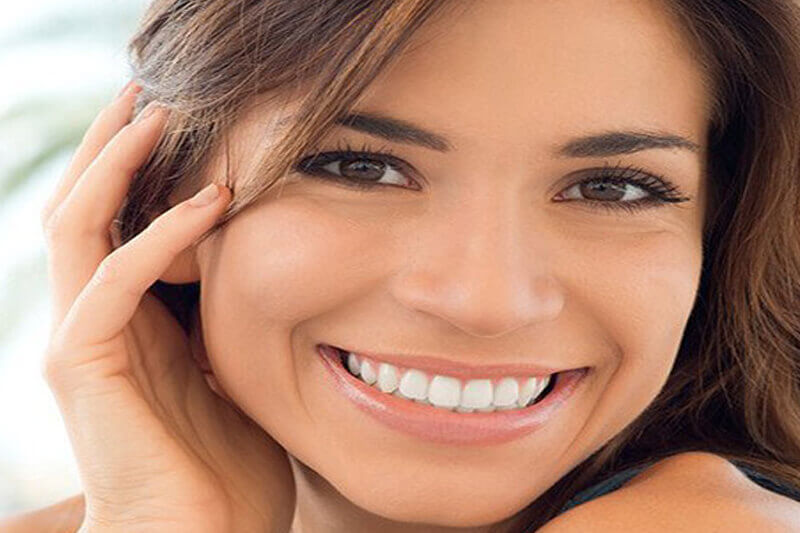 Picture of a smiling woman, happy with her dental veneers.