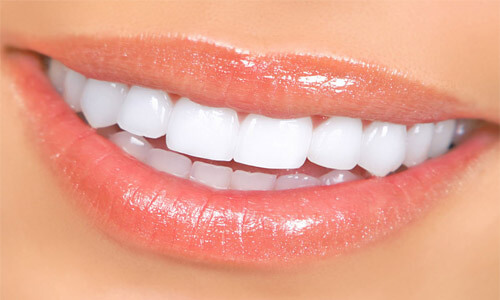 Close-up picture of a smiling happy woman with perfect teeth, showing her happiness with her All-on-Eight implant-supported denture  she had made in Costa Rica.