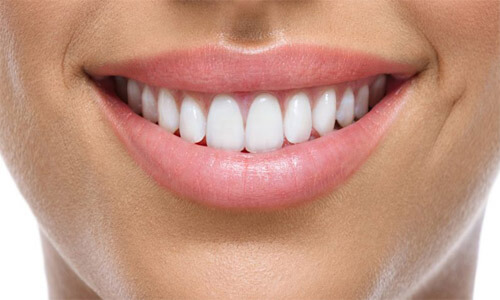 Close-up picture of a smiling happy woman with perfect teeth, showing her happiness with her All-on-Four implant-supported denture  she had made in Costa Rica.