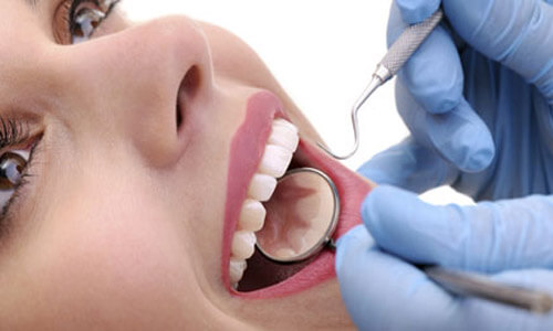 Close-up picture of a smiling young woman, showing perfect white teeth, and happy with her Holistic bone graft treatment at Premier Holistic Dental in Costa Rica.