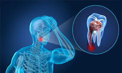 Illustratioin of a Cavitation treatment by Premier Holistic Dental in London.