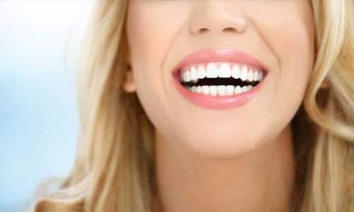 Close –up picture of a woman with long blonde hair and perfect teeth, smiling and showing her happiness with the crown lengthening procedure she had in Costa Rica.