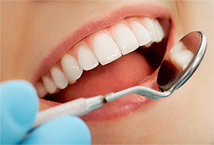 Illustration of a dental bonding procedure in Costa Rica.