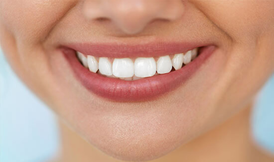 Picture of a smiling woman, showing her happiness with the all-on-four dental treatment she had in Costa Rica.