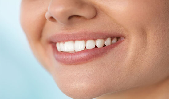 Picture of a woman, smiling at the camera, illustrating her happiness with the dental bridges she had in Costa Rica.