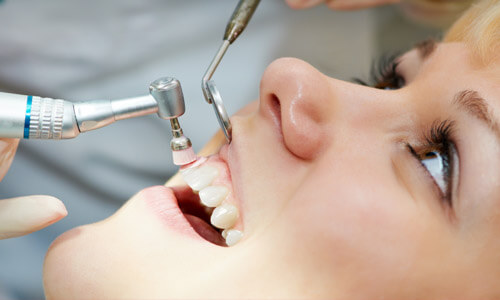 Close-up picture of a young woman sitting in a dental chair having her teeth cleaned.  A dentist is holding dental implements showing how Holistic dental cleaning is done by Premier Holistic Dental.