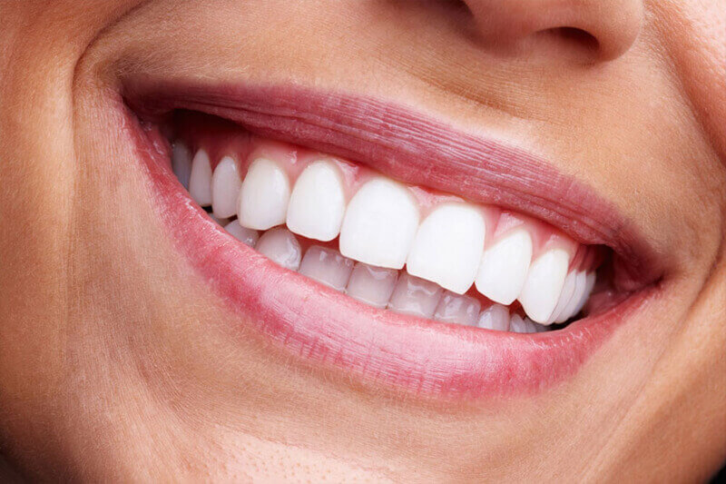 Picture of a smiling woman, happy with her dental implants.