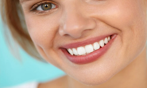 Close-up picture of a smiling woman with medium cut brown hair and perfect teeth, showing her happiness with the Holistic dentures she received in San Jose, Costa Rica.