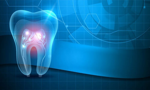 Illustration of a tooth showing how a laser is used in dental work.  The picture shows a blue tinted tooth against a blue background.