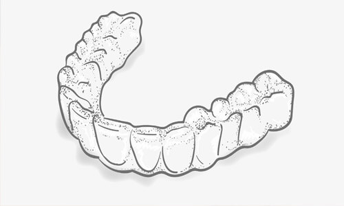 Close-up illustration of a clear Invisalign invisible brace.