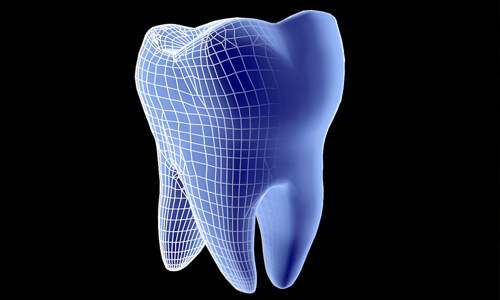 Illustration of a tooth showing a Prosthodontics procedure.  The illustration shows a blue colored tooth against a black background.