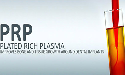 Illustration of the Platelet Rich Plasma (PRP) emblem.  The picture shows a vial of platelet rich plasma.
