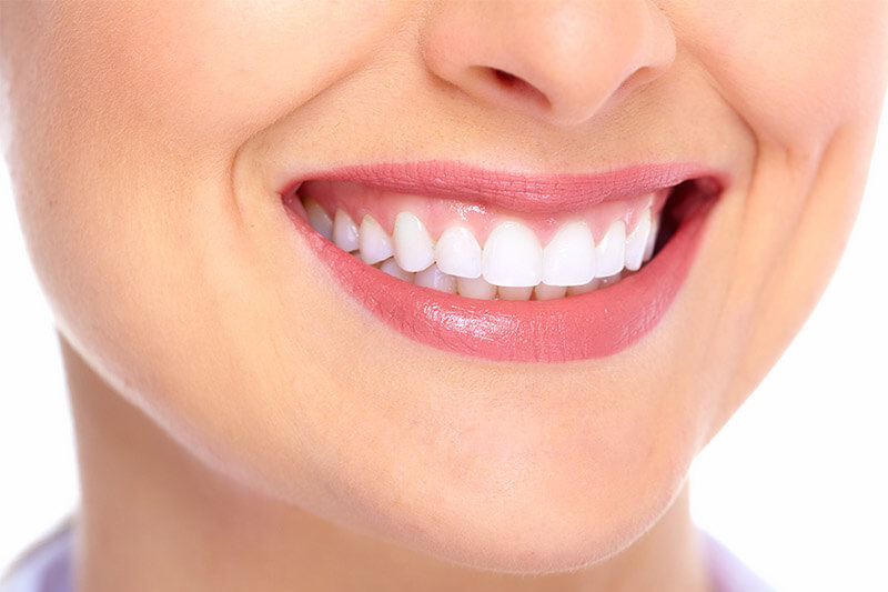 ).  Picture of a smiling woman, happy with her implant-supported dentures.