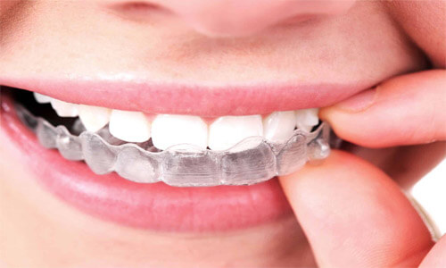 Close-up picture of a smiling young woman, holding her hand to her face to show perfect white teeth, and happy with her Holistic Invisalign procedure at Premier Holistic Dental in Costa Rica.