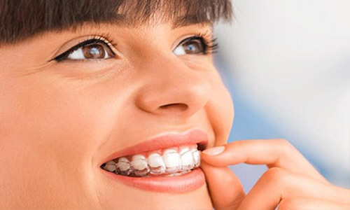 Close-up picture of a smiling woman with short brown hair, showing her perfect teeth, and happy with the orthodontics dental work she had done at Premier Holistic Dental in San Jose, Costa Rica.