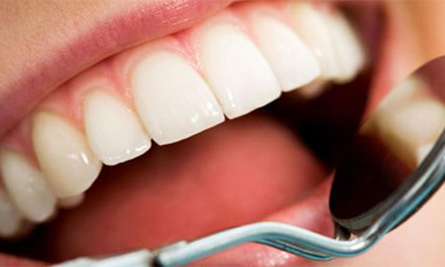 Close-up picture of a smiling young woman, showing perfect white teeth, and happy with her Holistic root canal treatment at Premier Holistic Dental in Costa Rica.