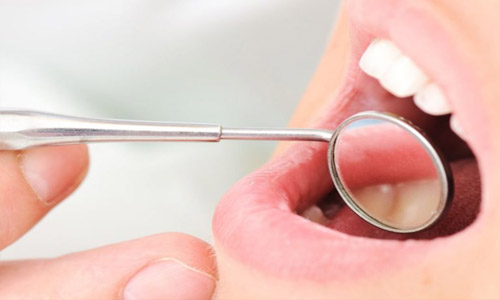 Close –up picture of a woman sitting in a dentist’s chair having a dentist preparing for a scaling and root planing procedure in Costa Rica.