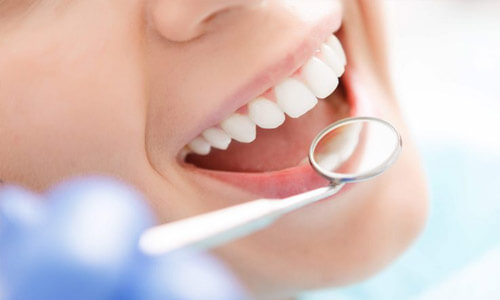 Close-up picture of a smiling young woman, showing perfect white teeth, and happy with her Holistic sinus lift treatment at Premier Holistic Dental in Costa Rica.