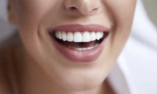 Close-up picture of a smiling woman with perfect teeth showing her happiness with the dental veneers she received at Premier Holistic Dental in Costa Rica.